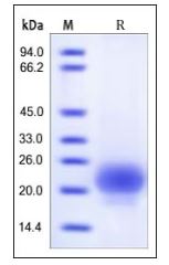 Human R-Spondin 1, His Tag on SDS-PAGE under reducing (R) condition. The gel was stained overnight with Coomassie Blue. The purity of the protein is greater than 95%.